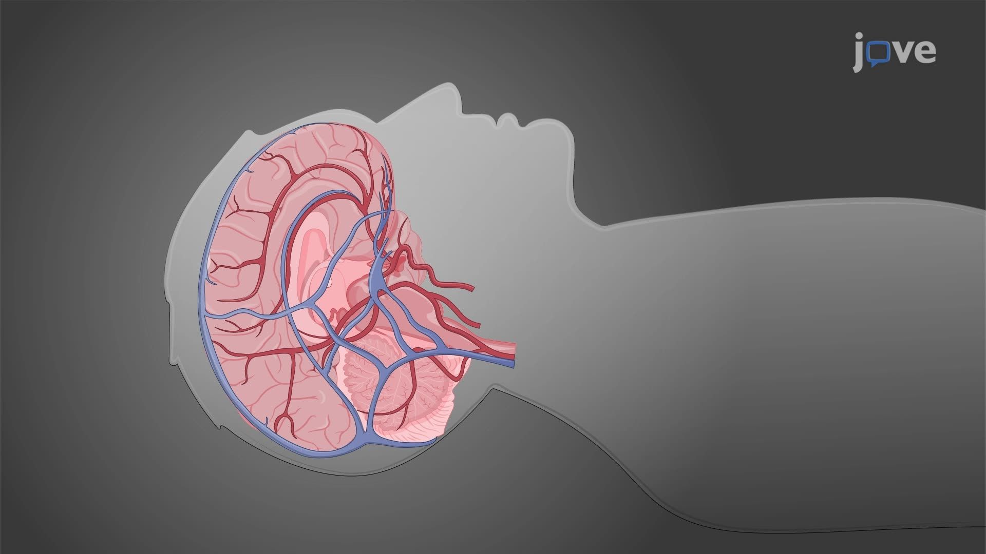 Time-of-Flight Magnetic Resonance Angiography to Visualize Blood Vasculature