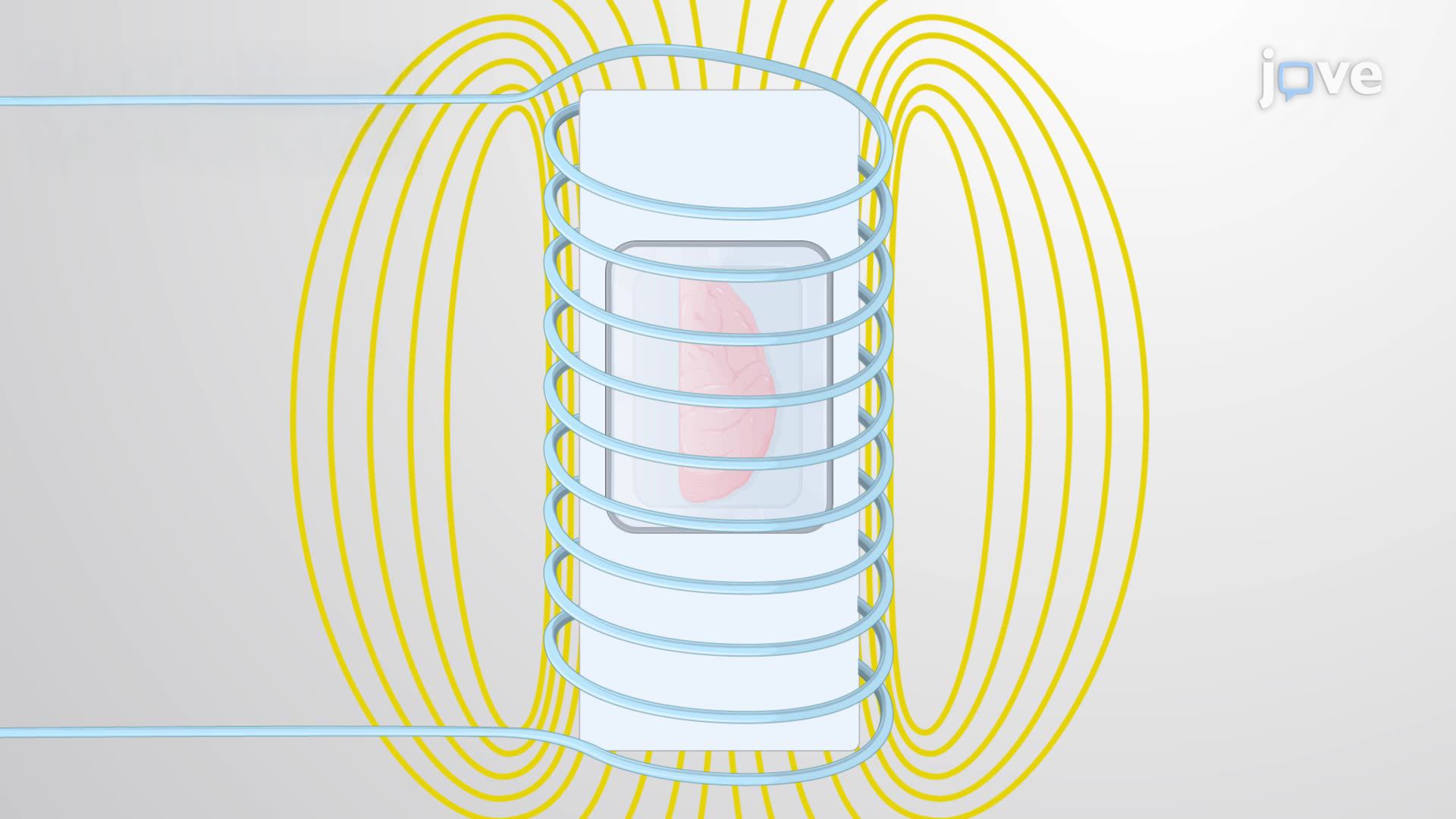 Quantitative Susceptibility Mapping of a Human Brain Using Ex-Vivo Magnetic Resonance Imaging