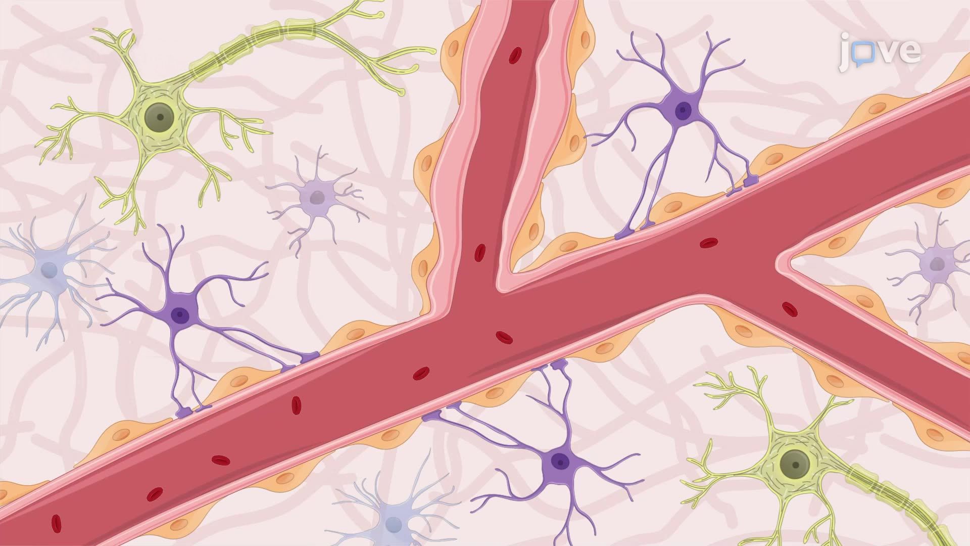 Dark Blood Magnetic Resonance Imaging for Visualizing Inflamed Intracranial Arteries