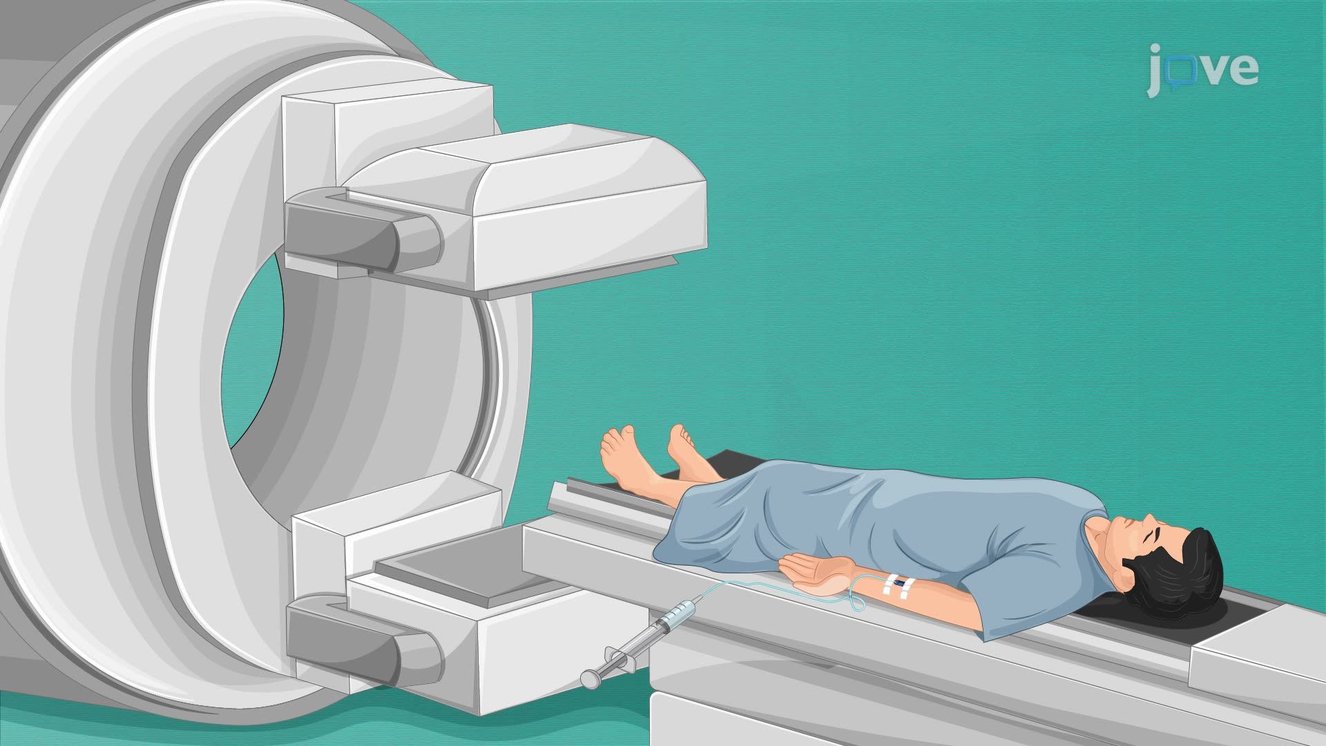 Single Photon Emission Computed Tomography for Assessing Brain Function Disruption