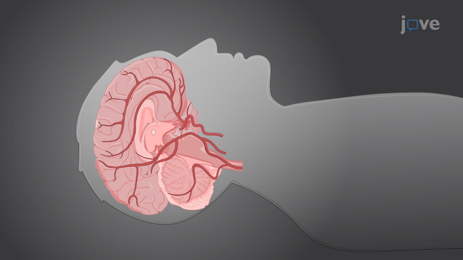 Measuring Cerebral Blood Volume in the Auditory Cortex Using Vascular Space Occupancy