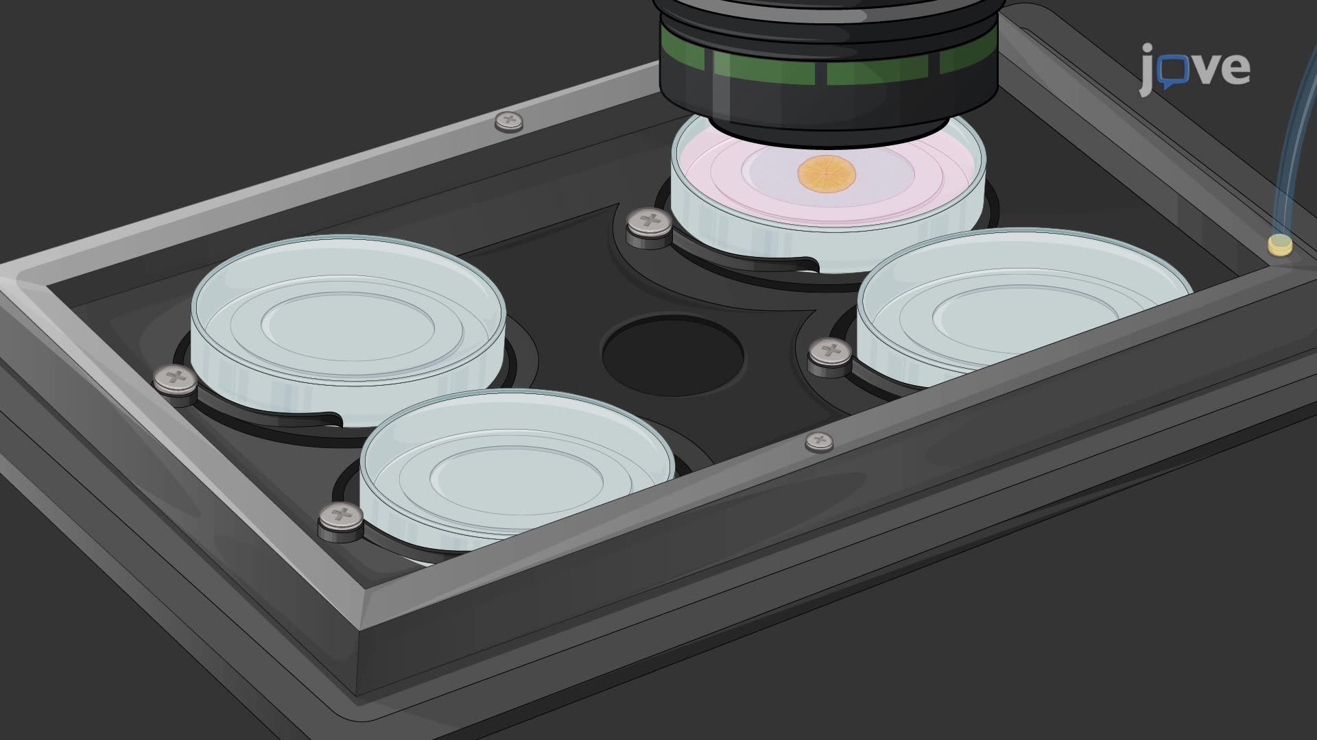 Live Cell Imaging of Muller Glial Nuclear Migration During Zebrafish Retinal Regeneration