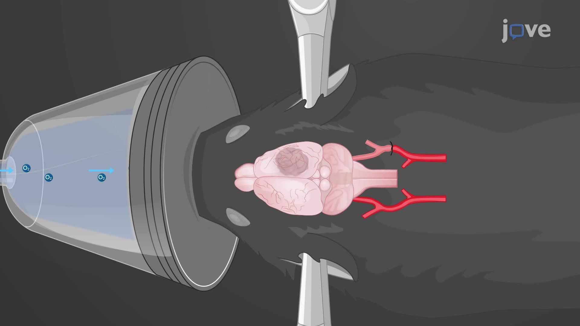 Imaging Brain Damage Induced by Cerebral Hypoxia-Ischemia in a Mouse Model