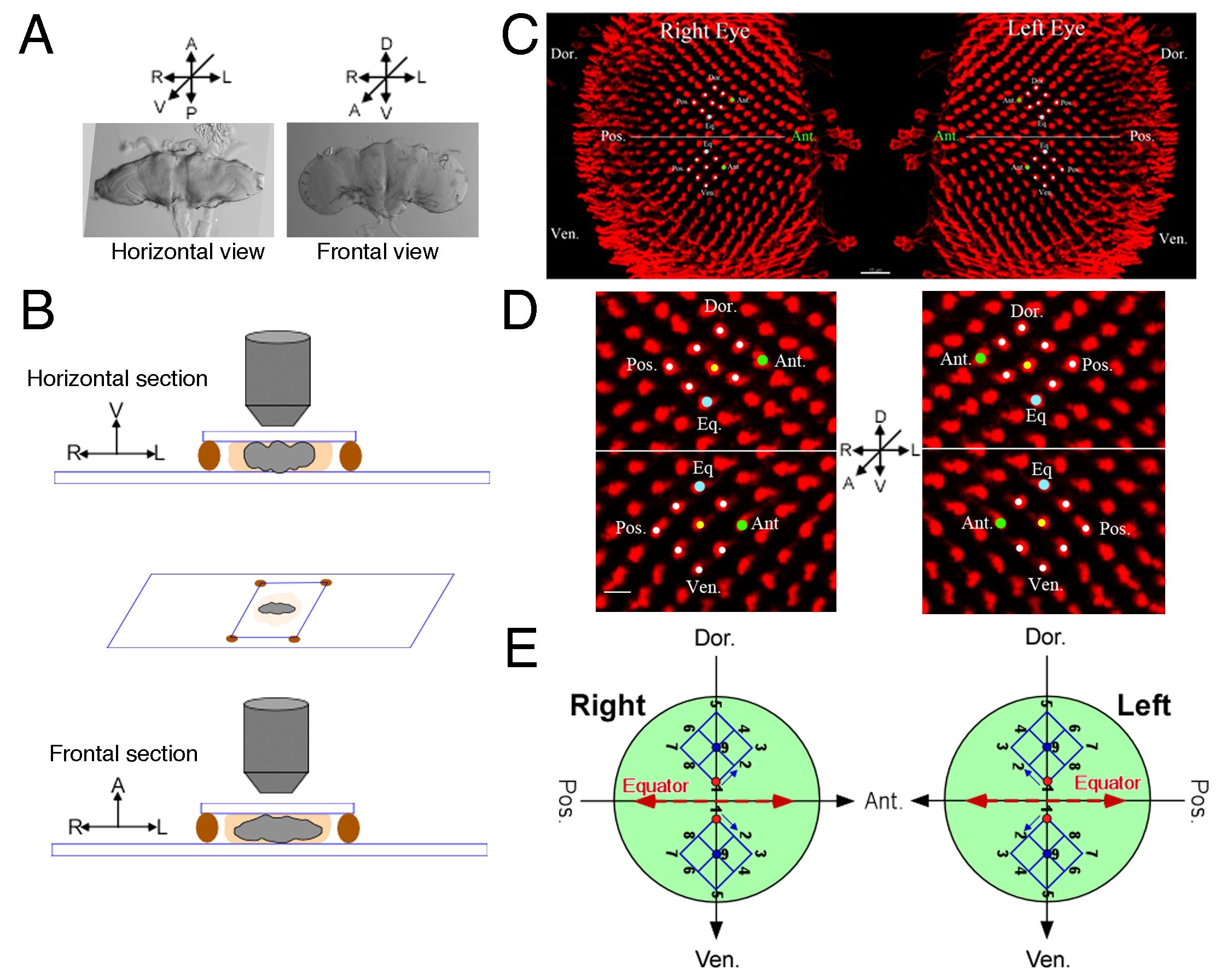Horizontal and frontal brain section diagrams, eye analysis images, directional symbols.