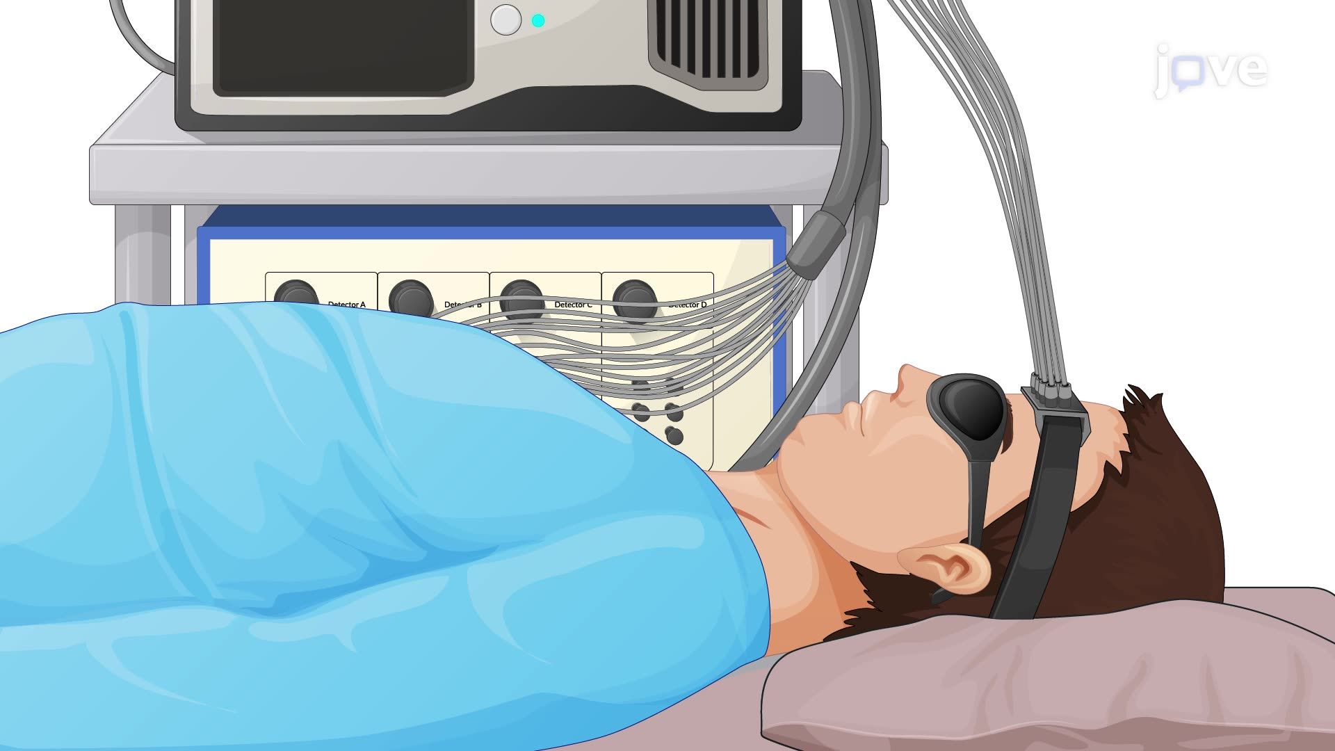 Diffuse Correlation Spectroscopy to Measure Cerebral Blood Flow in a Human Subject