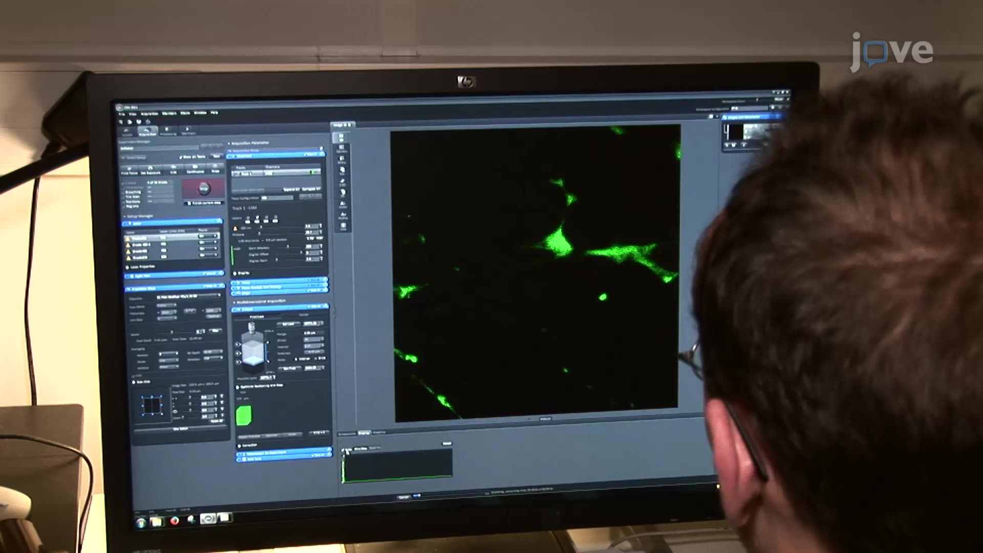 Video: Quantification of Dendritic Spines Using Confocal Microscopy ...