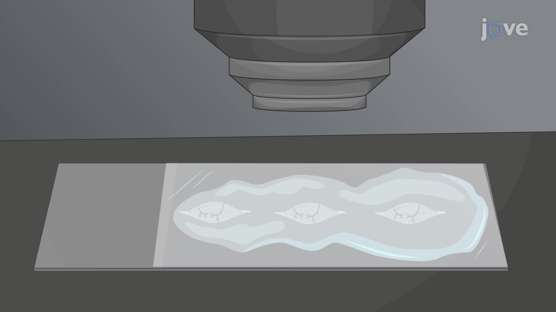 Characterization of Neuromuscular Junctions in Mice by Combined Confocal and Super-Resolution Microscopy