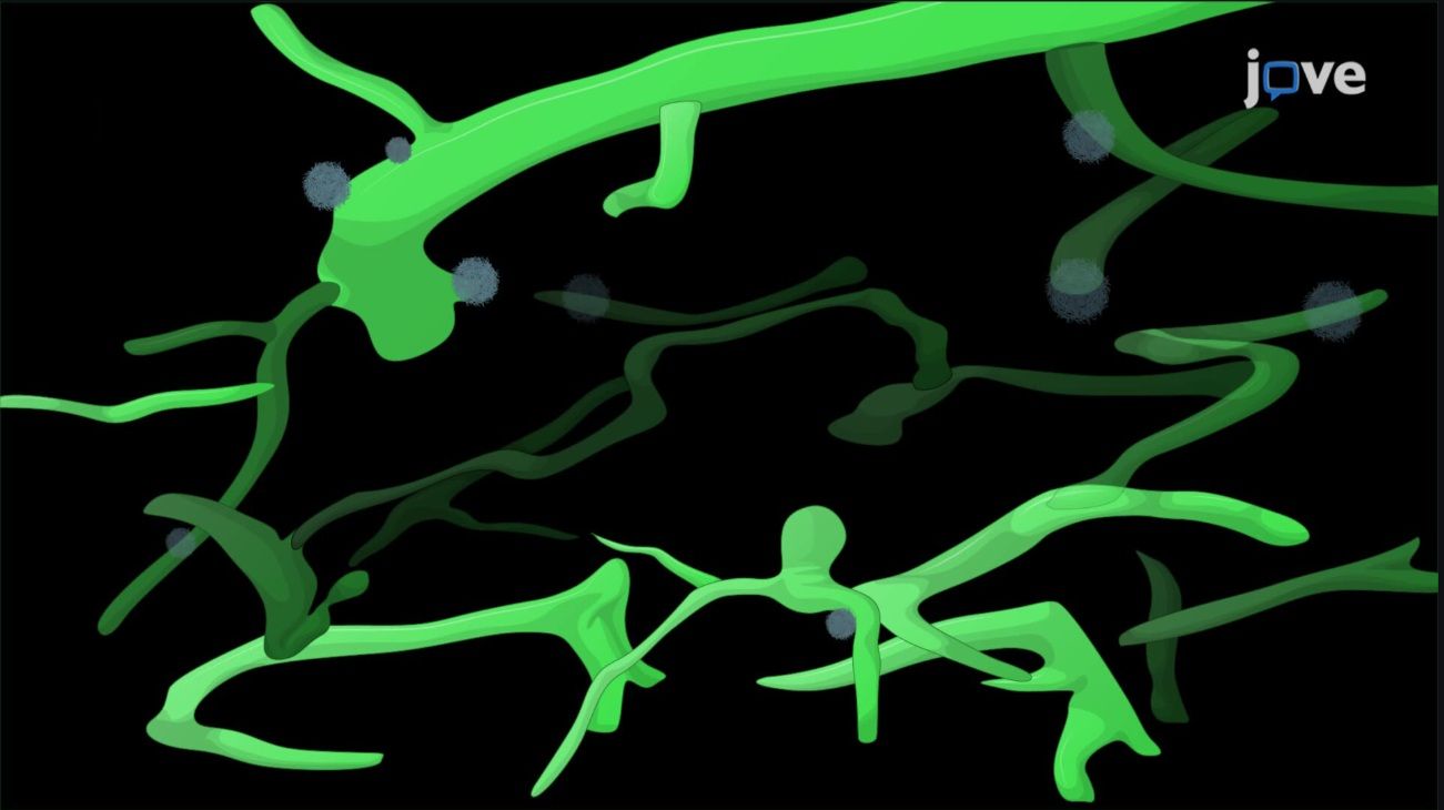 In Vivo Imaging of Cerebral Vessels and Amyloid Plaques in an Alzheimer’s Disease Mouse Model