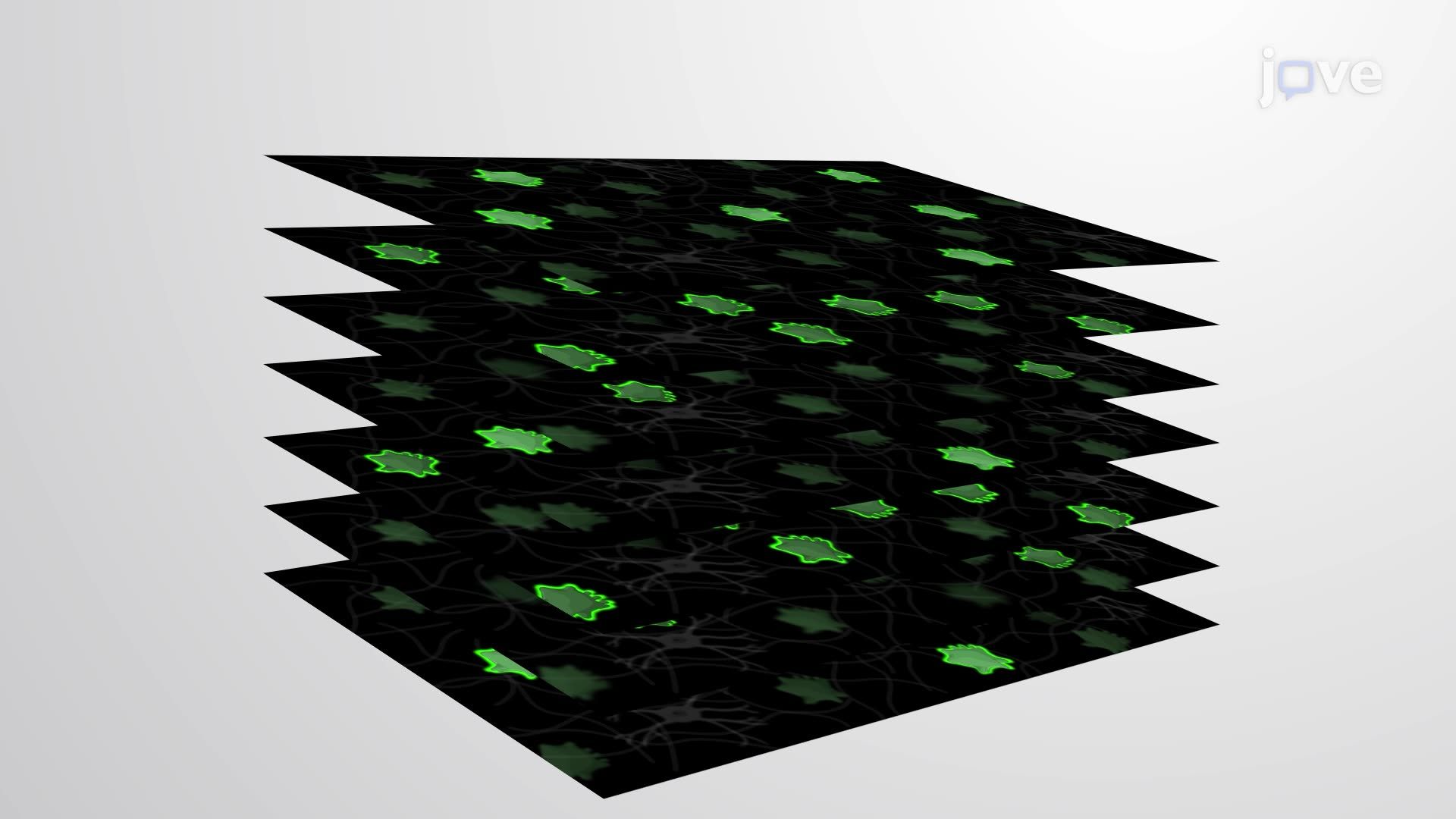 Imaging Tumor Cell Migration in Glioblastoma Tissue Using Time-Lapse Scanning Confocal Microscopy