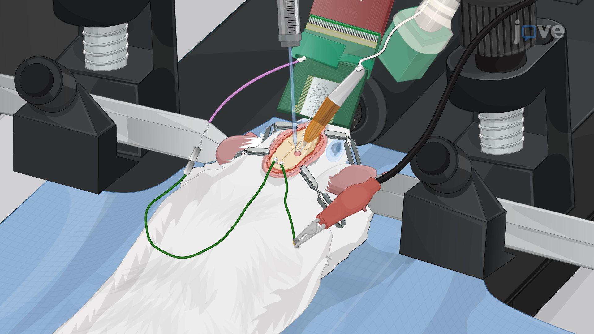Electrophoretic Delivery of GABA into the Epileptic Focus of an Anesthetized Mouse