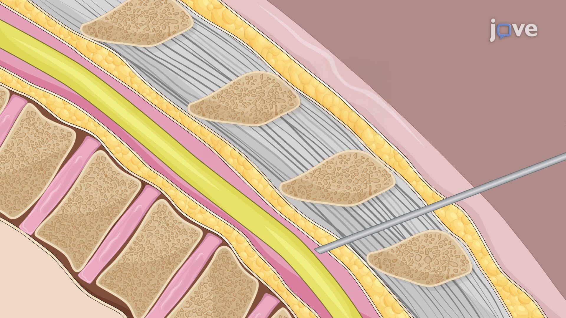 Intrathecal Delivery of Viruses in a Mouse Model for Treating Central Nervous System Diseases