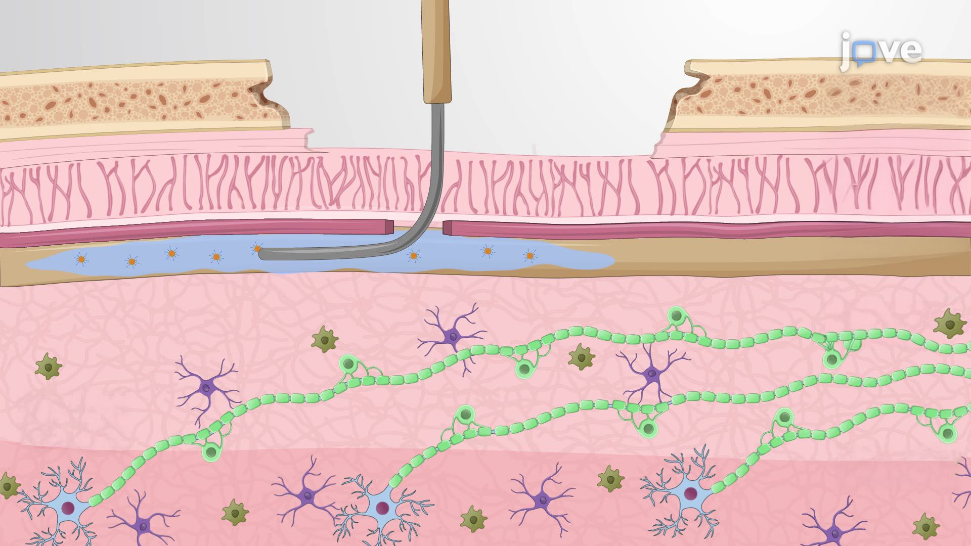 Subpial Gene Delivery in the Mouse Spinal Cord to Evaluate Gene Expression