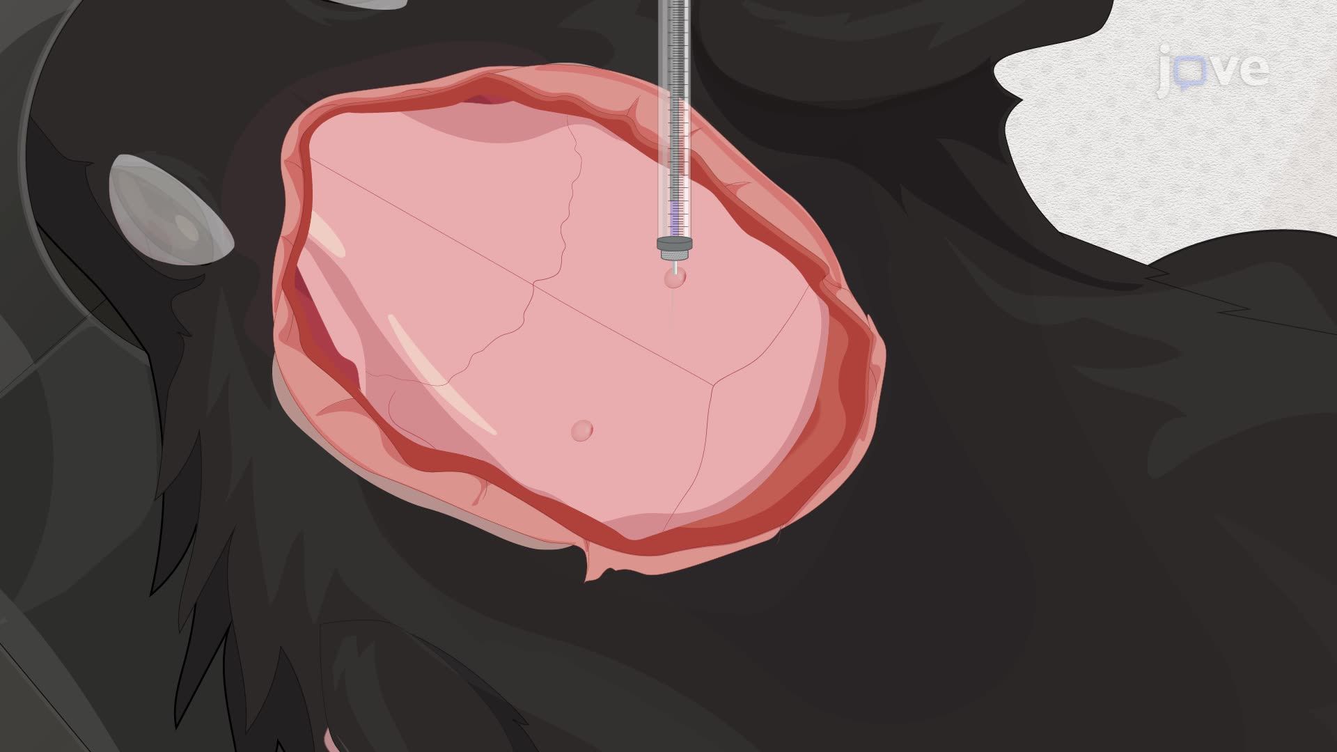 Stereotaxic Viral Injection for Targeted Neuronal Gene Editing in the Mouse Brain