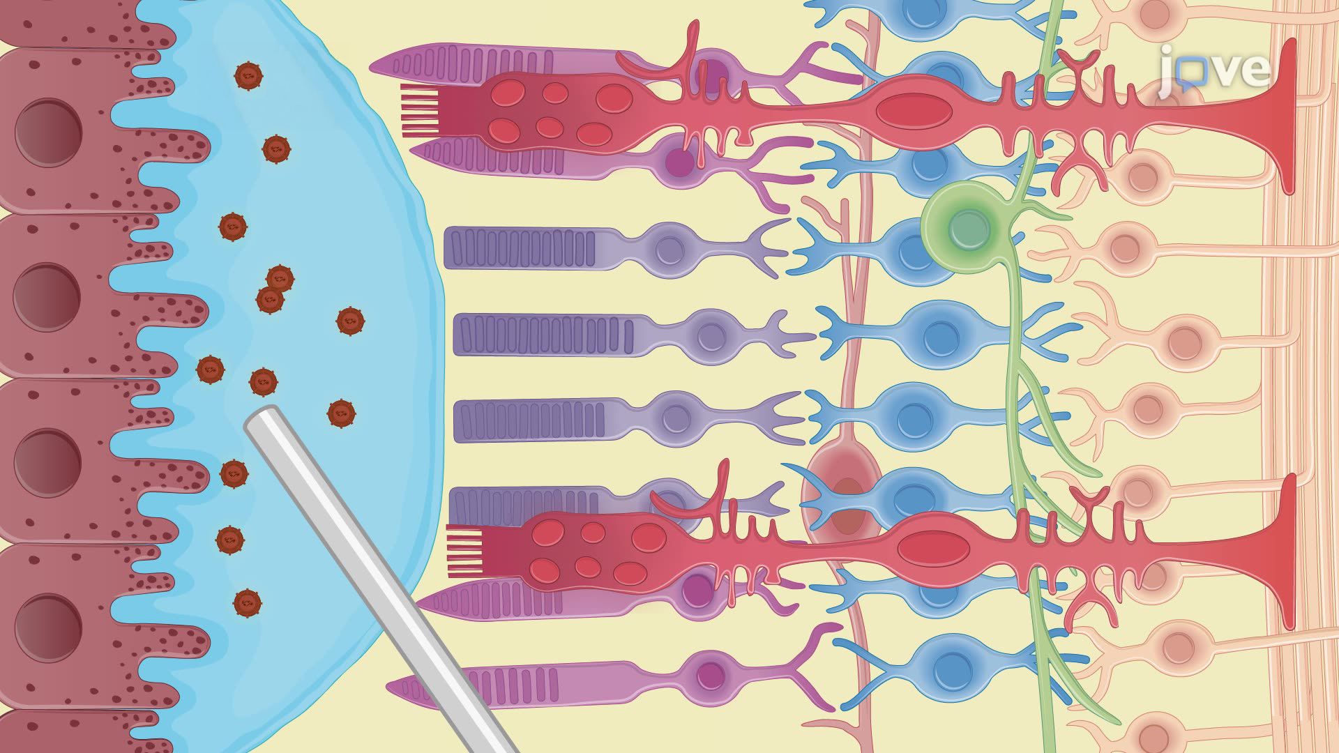 Subretinal Injection of Viral Vectors into the Retinal Pigment Epithelium in a Mouse Model