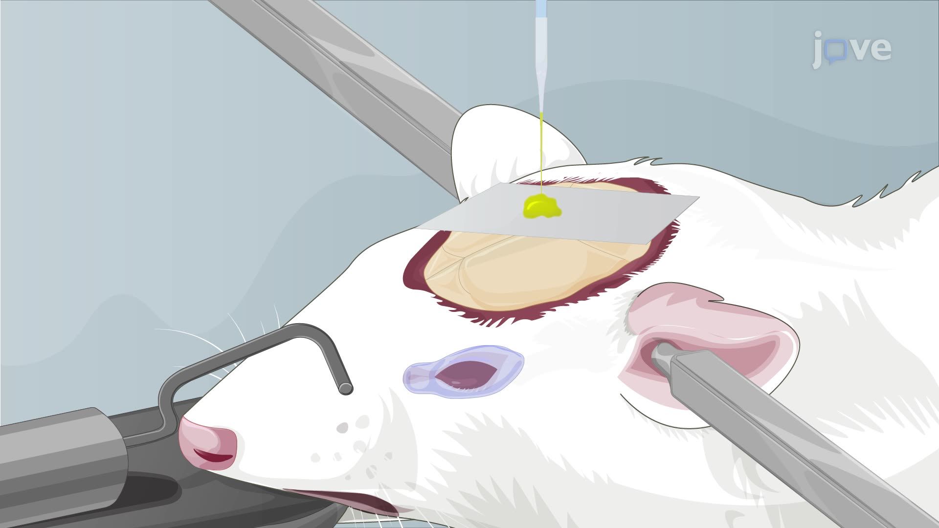 Rodent Brain Microinjection Using a Quartz Microneedle