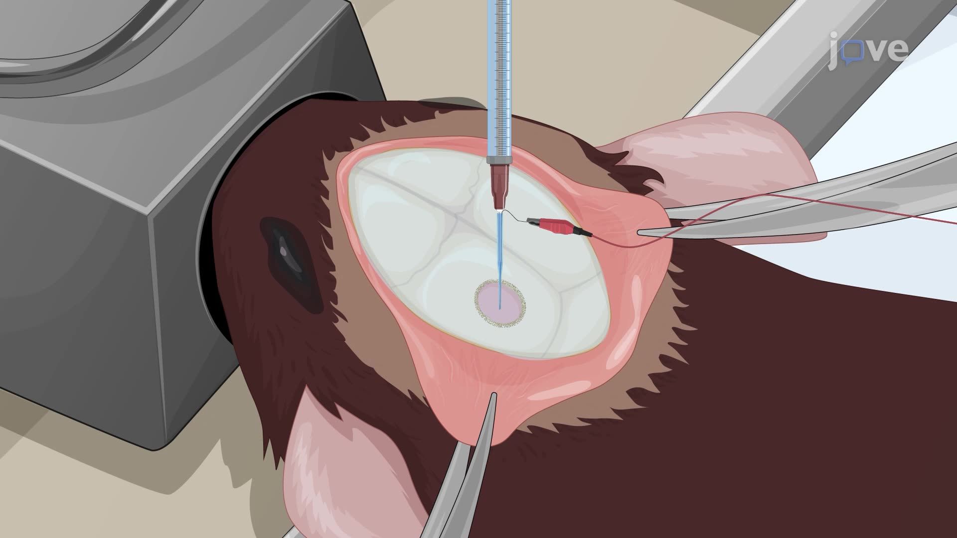 Inhibition of Neuronal Activity and Its Detection Using Electrophysiology in a Rat