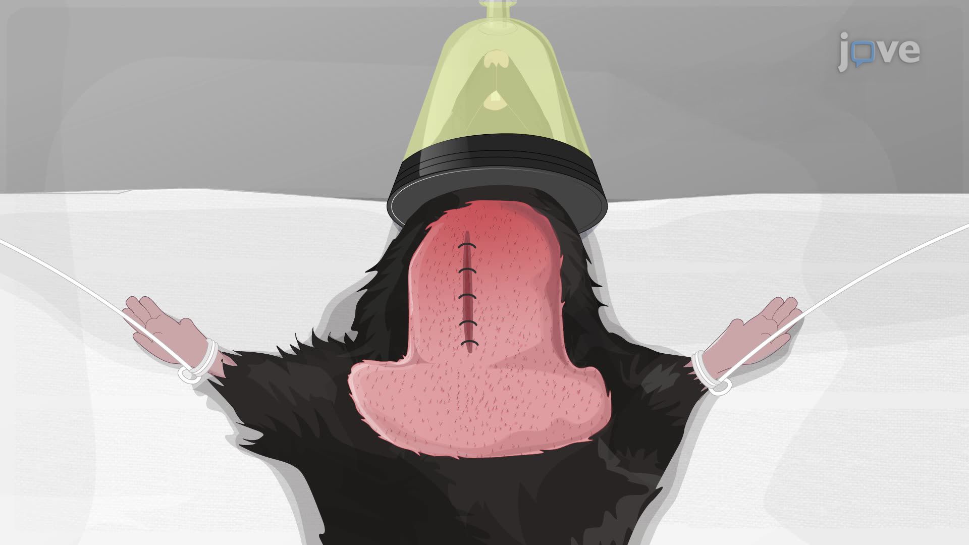 Evaluación de los efectos neuroprotectores del postacondicionamiento ácido en un modelo de ratón de isquemia cerebral