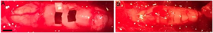 Surgical procedure showing brain exposure with electrodes for neural activity recording experiment.