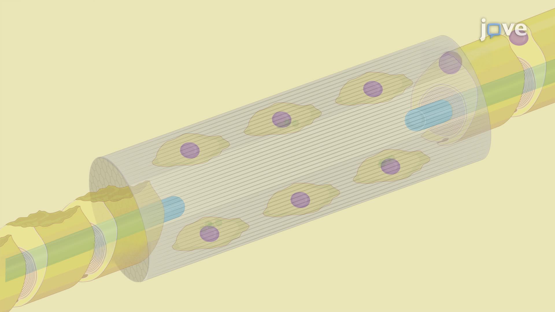 Nerve Repair Using a Bionic Conductive Scaffold Combined with Electrical Stimulation