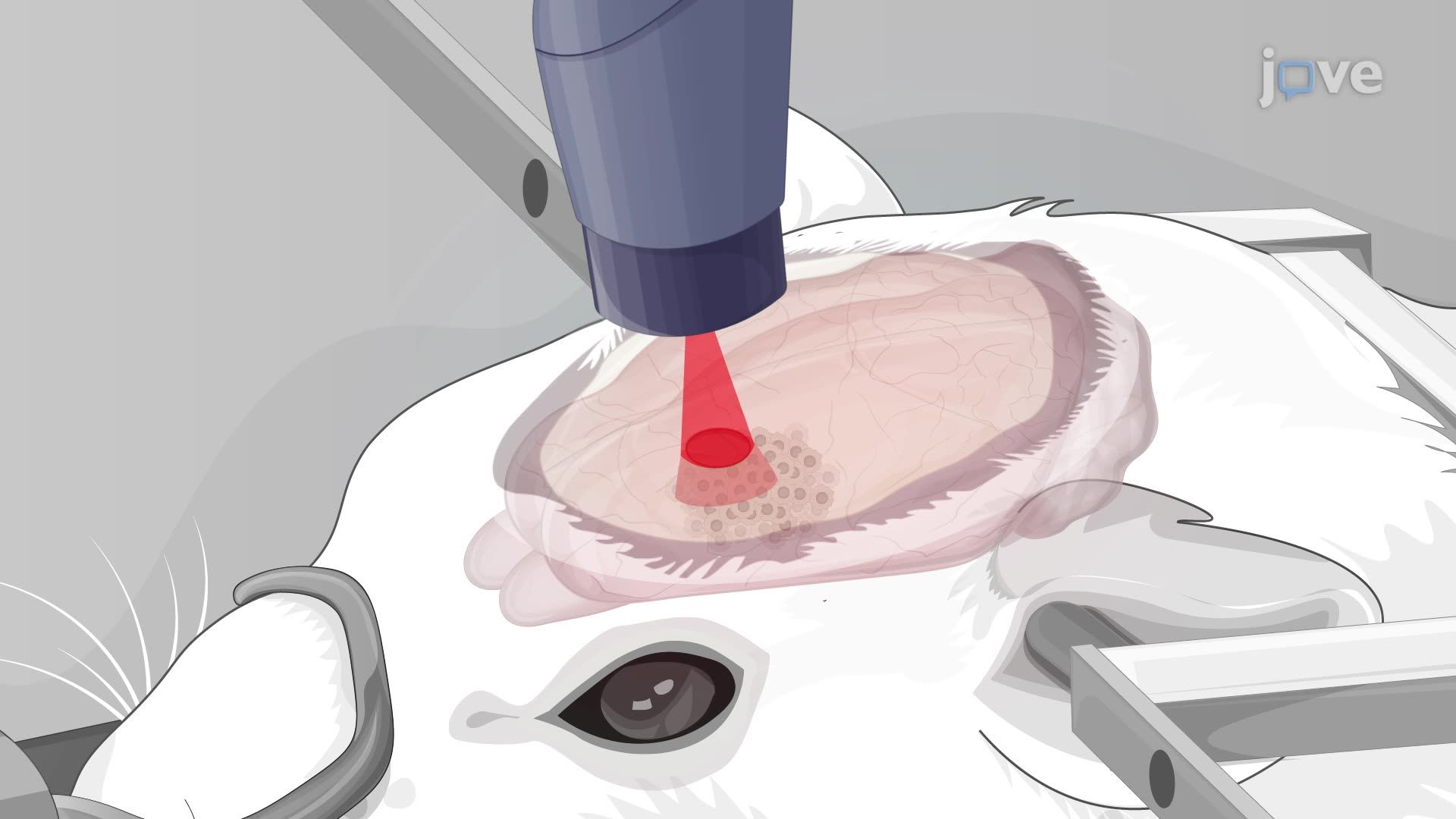 Thermally Responsive Biopolymer-Based Inhibition of Tumor Progression in a Rat Model