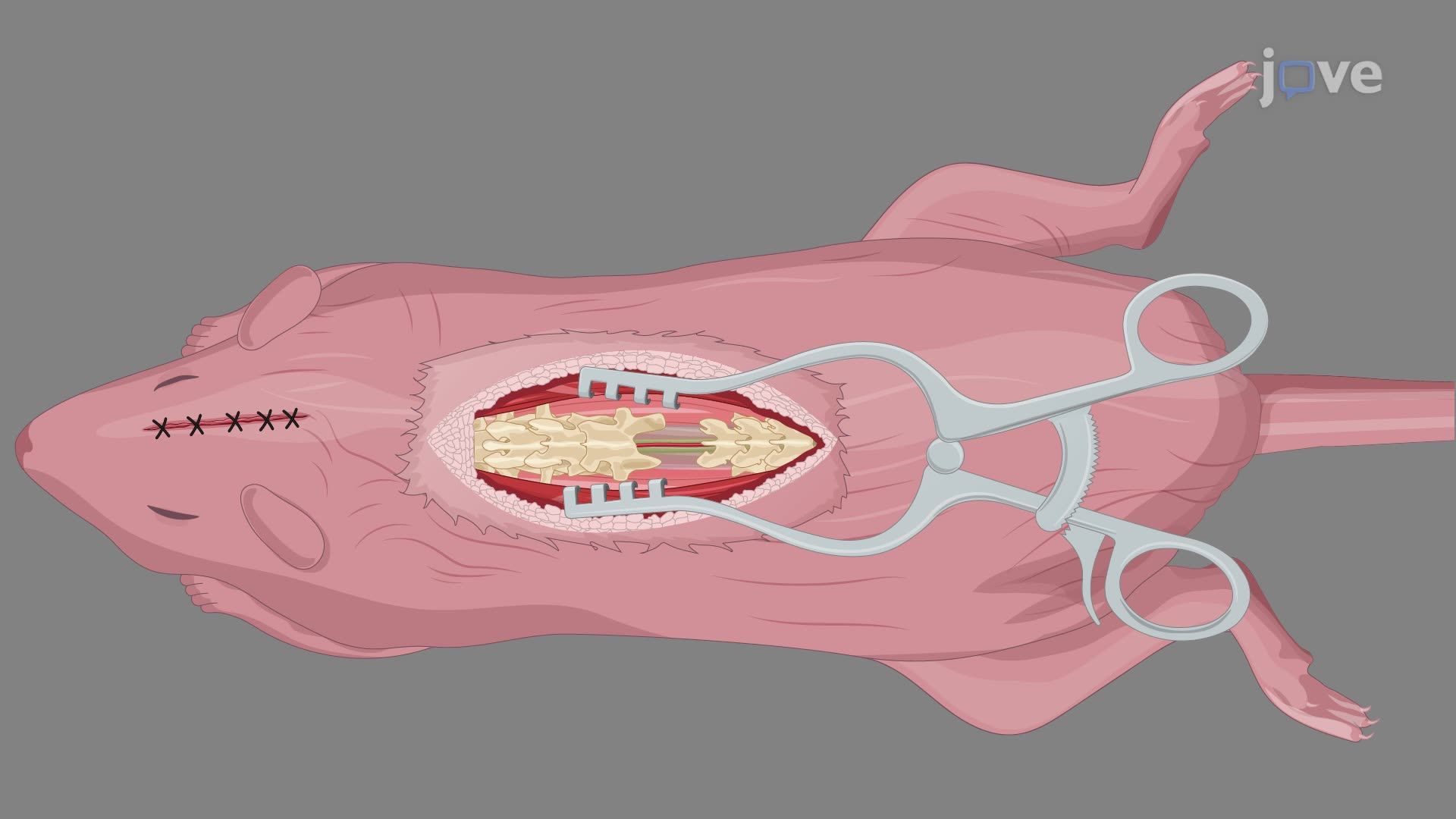 Targeted Viral Delivery to Corticospinal Neurons in a Neonatal Rat to Study Spinal Cord Injury