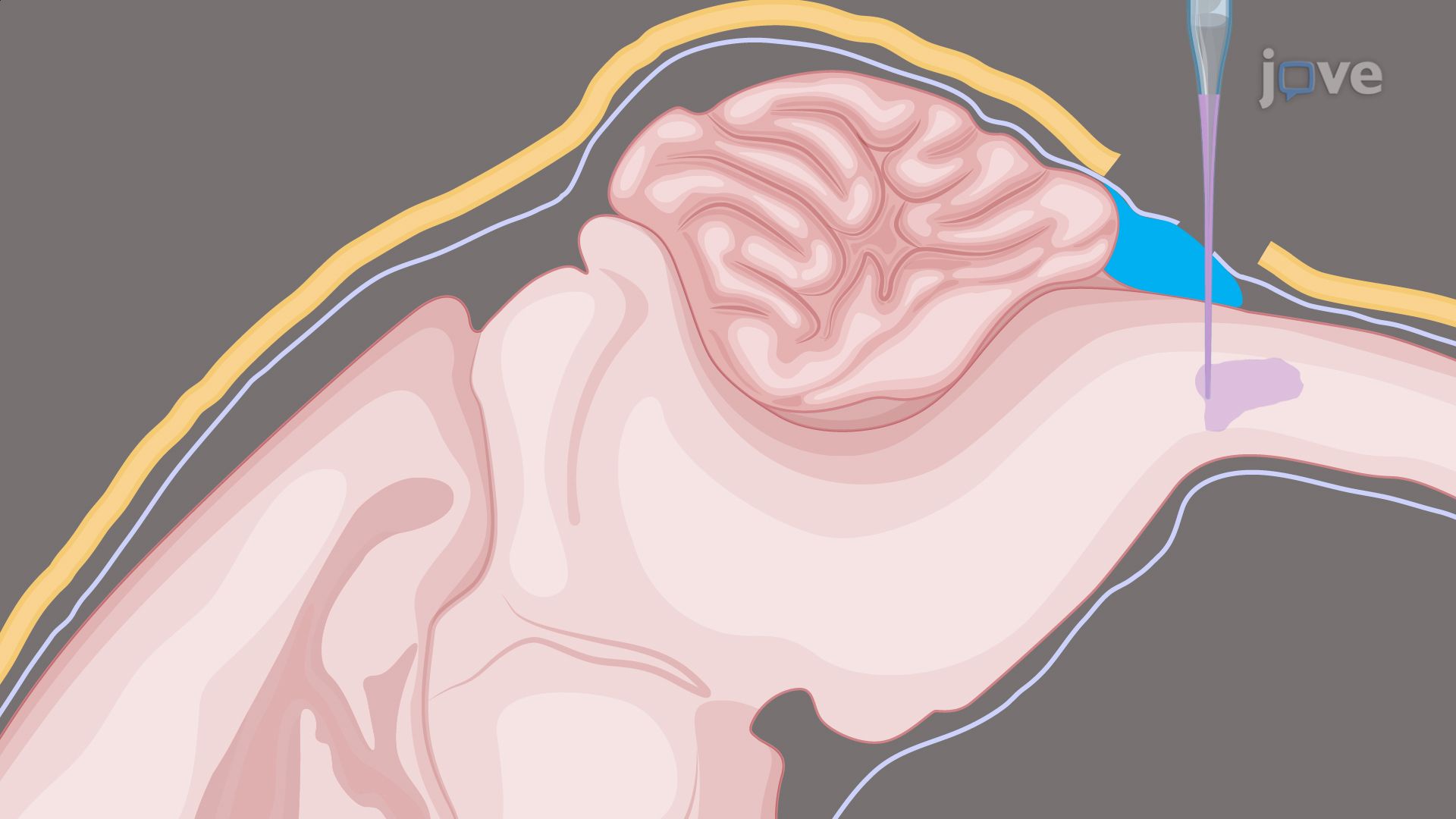 Stereotaxic Cisterna Magna Approach for Therapeutic Delivery in a Mouse Model