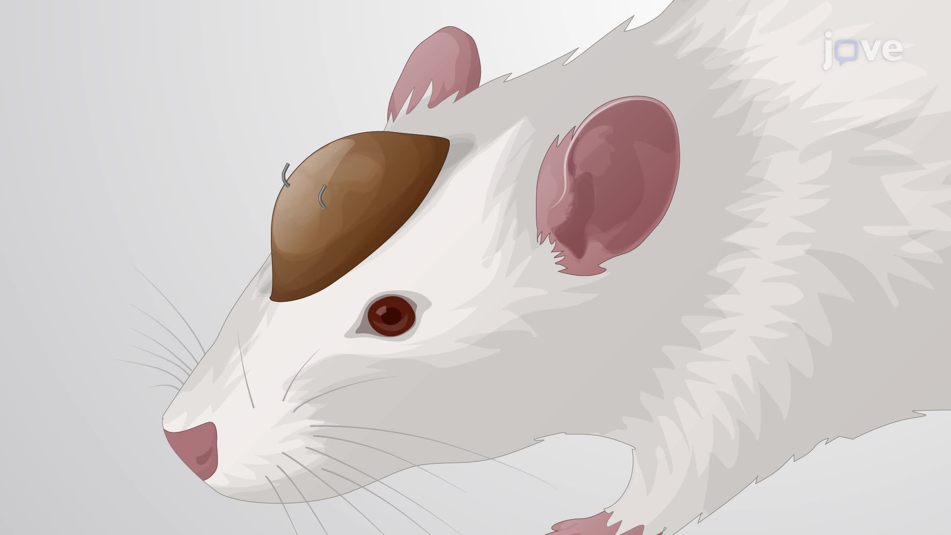 Microinjection-Based Delivery of a Therapeutic Agent into an Awake Rodent Brain