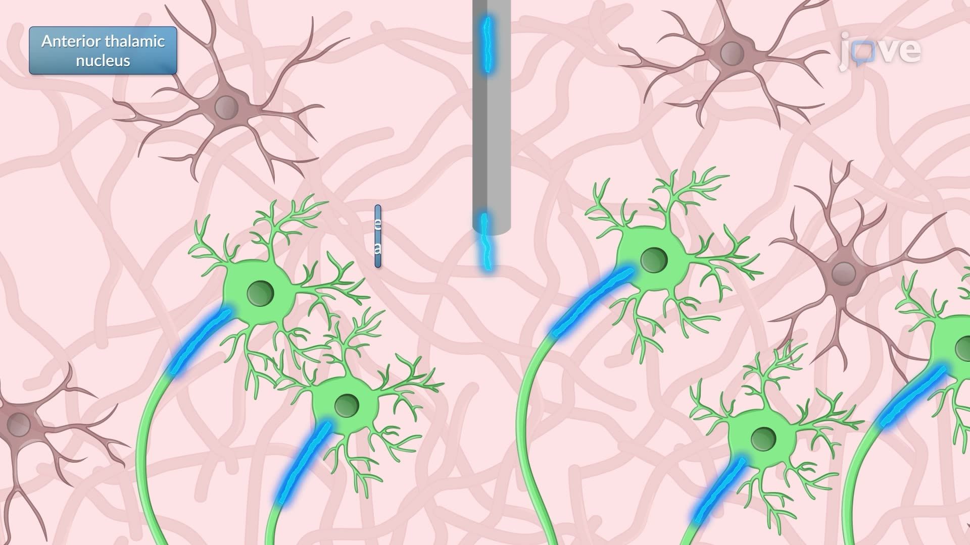 Effects of Deep Brain Stimulation on Hippocampal Neuronal Activity in a Rat Model