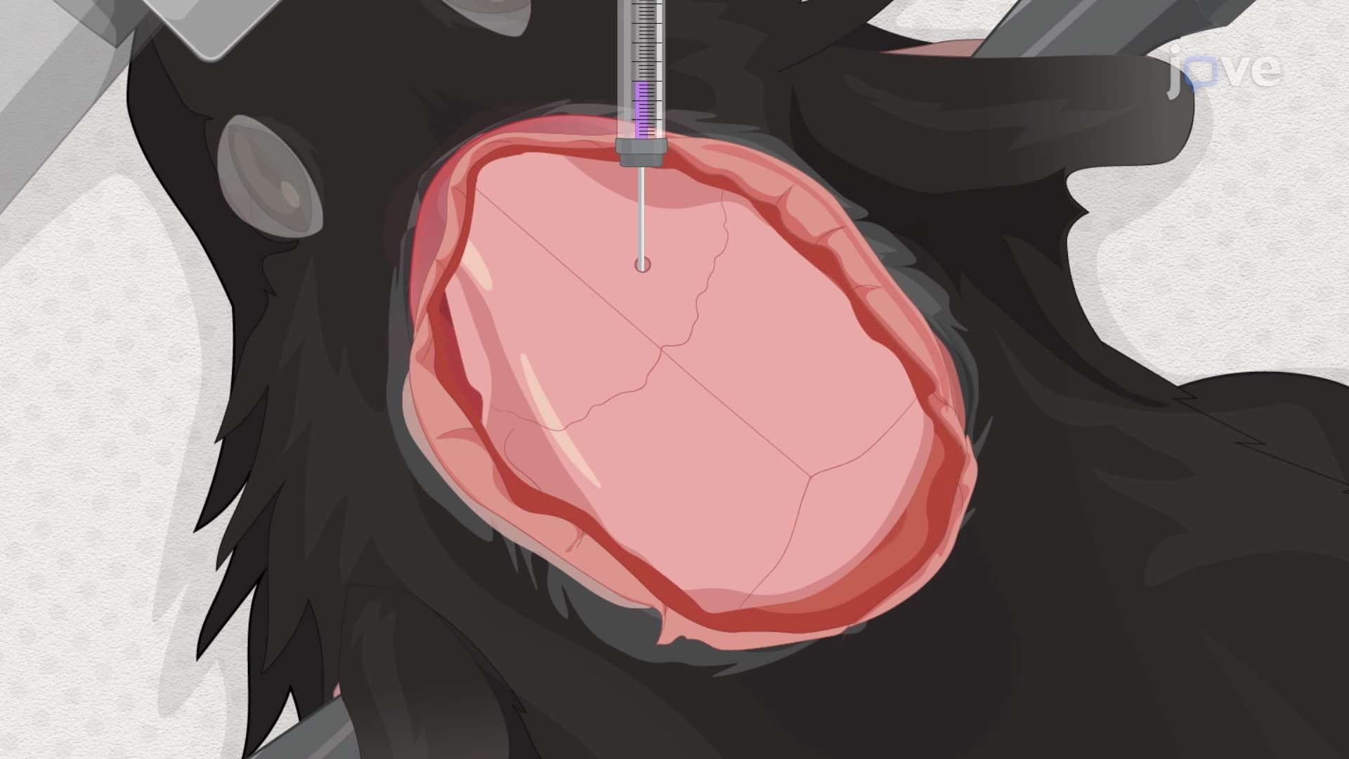 Трансплантация нейронных клеток-предшественников человека в мозг мыши