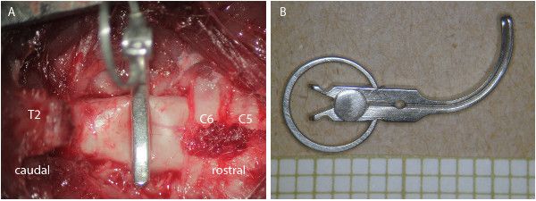 Spinal cord surgery setup with vertebral clamp, T2-C5 exposure; experimental tool detail.