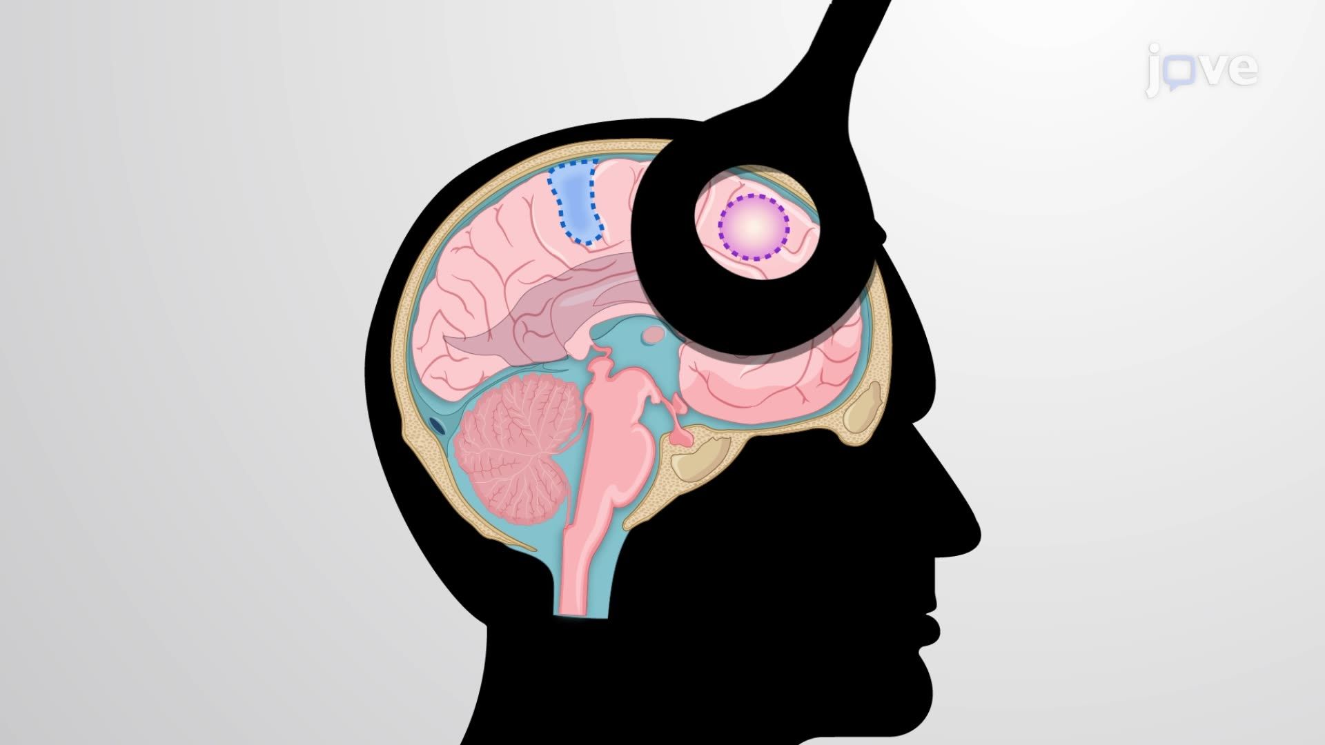 Continuous Theta Burst Stimulation to Reduce Responses to Ideological Threats