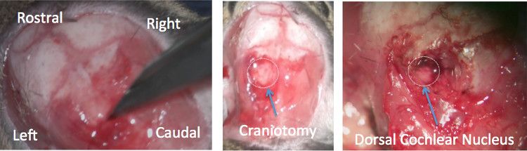Craniotomy procedure, dorsal cochlear nucleus exposure, surgical approach diagrams.