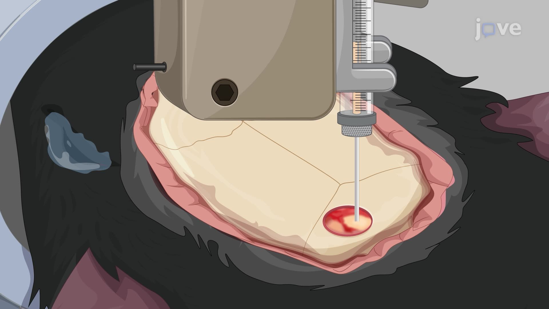Virus-Mediated Gene Transfer Into the Mouse Dorsal Cochlear Nucleus for Light-Induced Auditory Stimulation