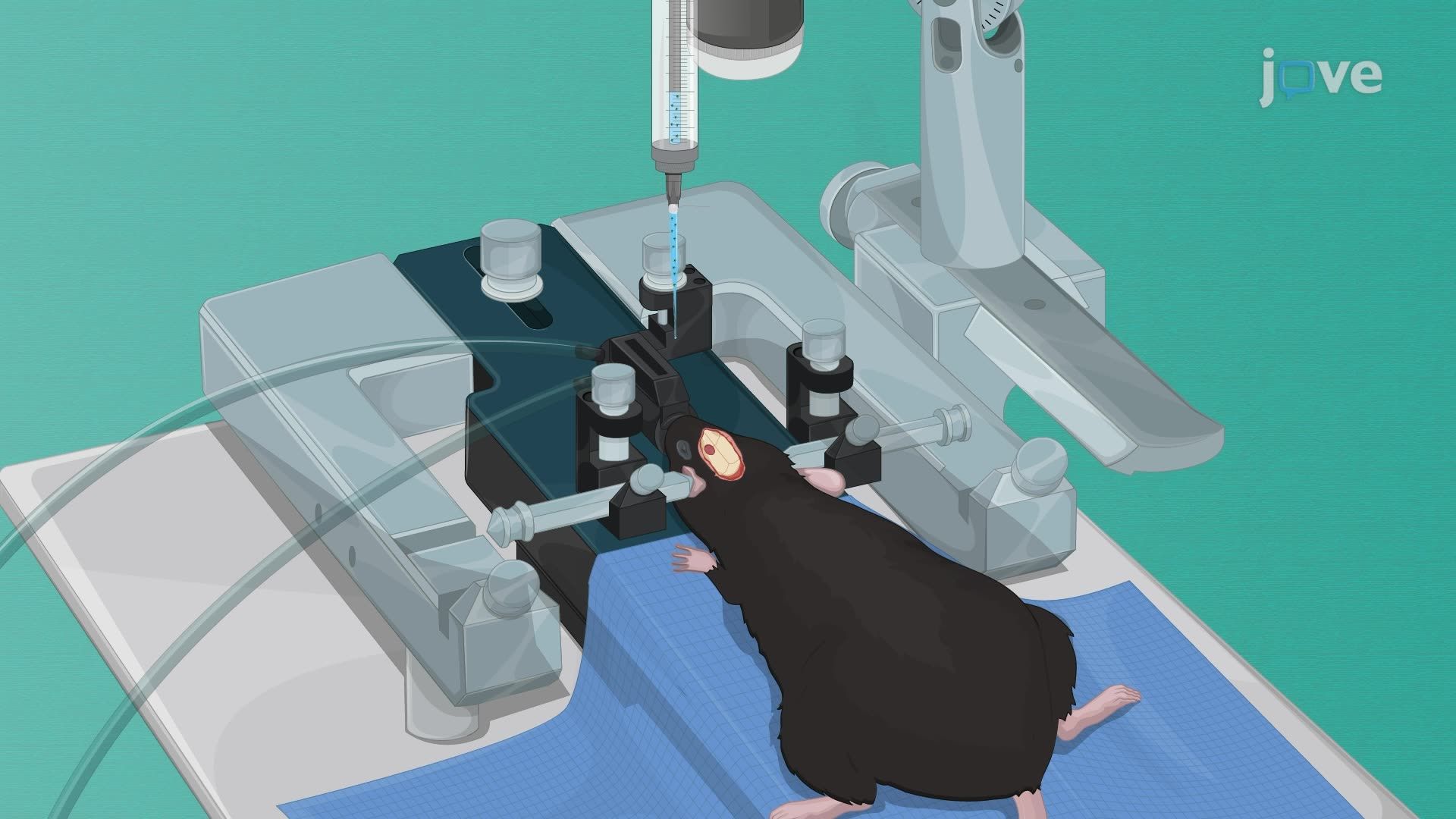 Trasplante estereotáxico de suspensión de células neurales en un ratón con lesión cerebral traumá...