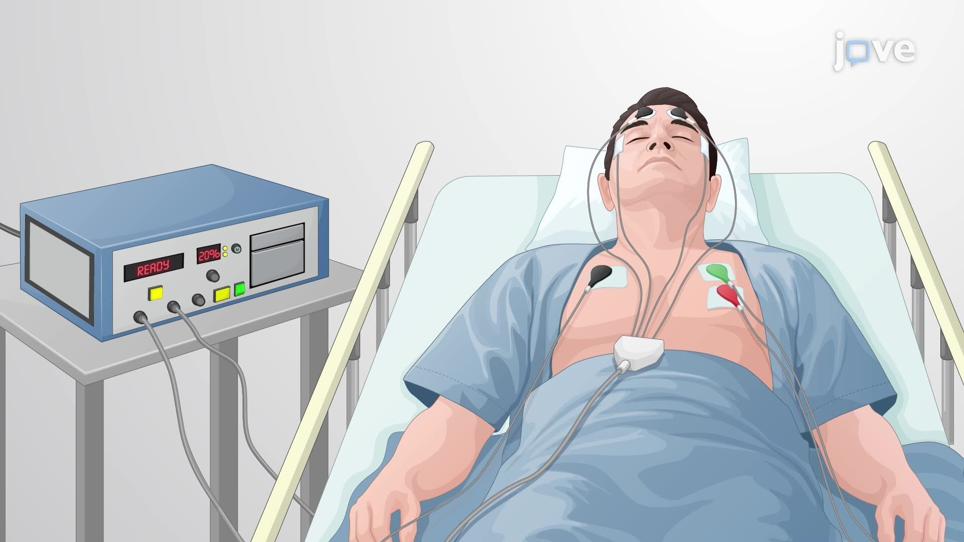 Performing Electroconvulsive Therapy and Assessing Seizure Efficacy via Pupillary Response