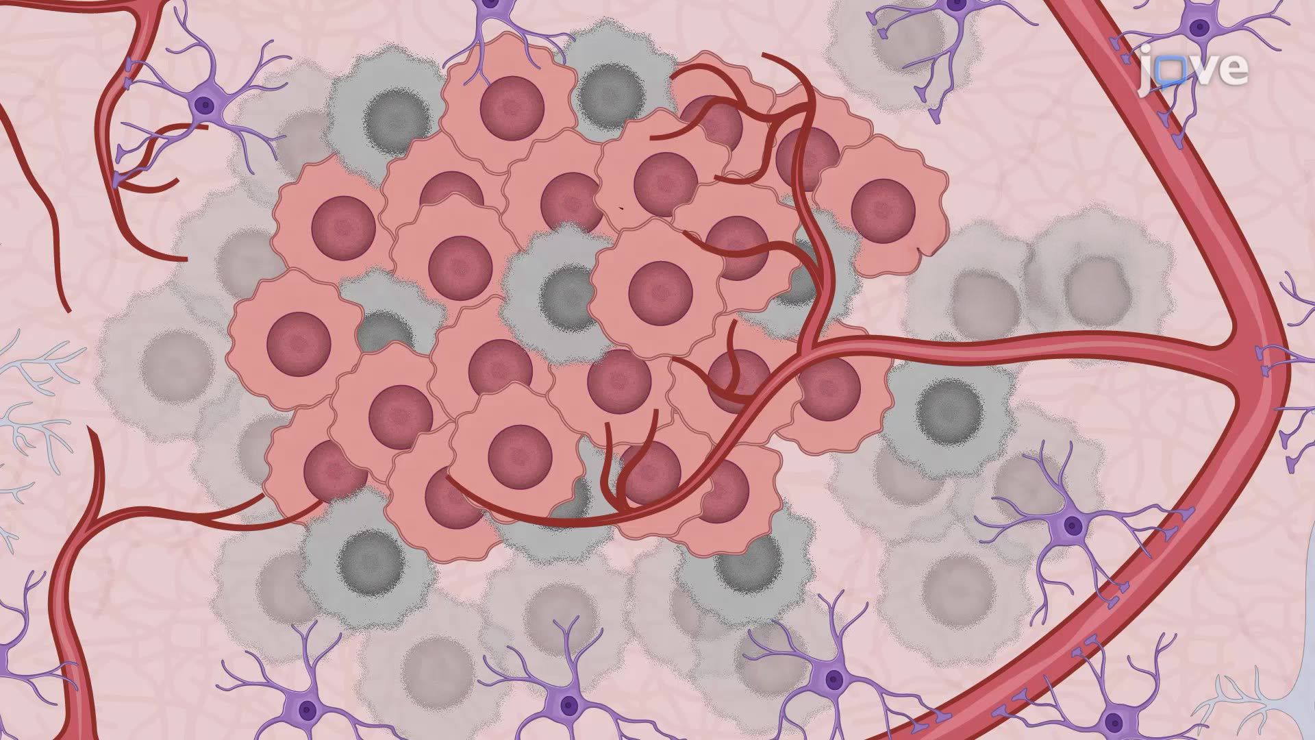 Treatment of Brain Tumors in a Mouse Model Using Sonodynamic Therapy