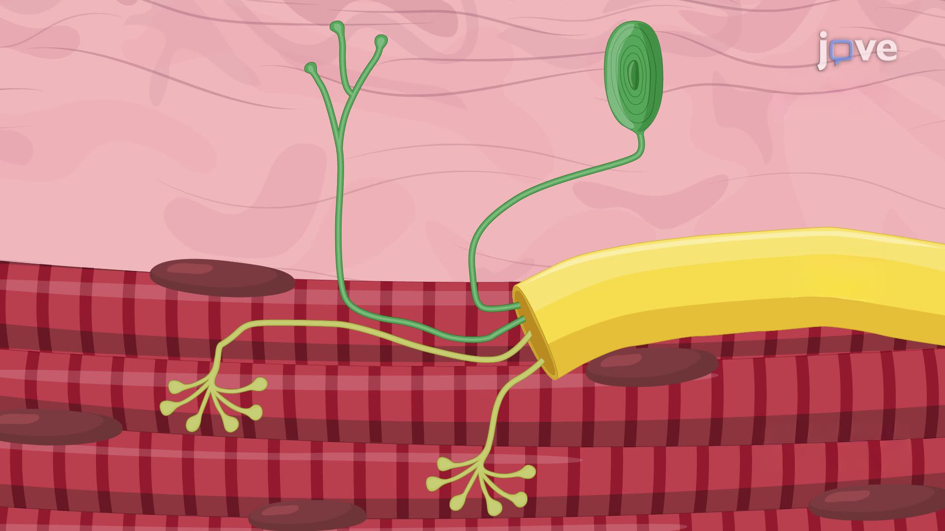 Sinir Yaralanmasının Sıçan Modelinde Kompozit Rejeneratif Periferik Sinir Arayüzünün İnşası