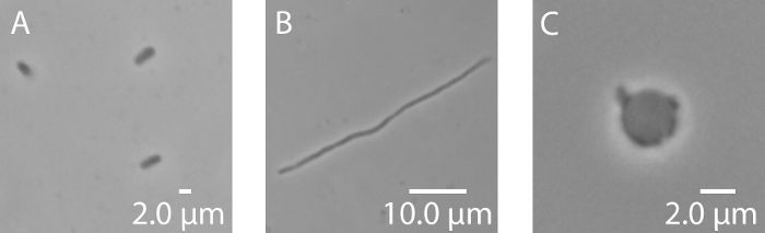 Bacterial cells and structures in microscope image, scale bars indicate size comparison.