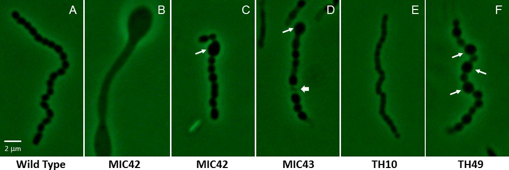 figure-results-1 Wild type and mutant bacterial cell morphology, microscopy images showing structural differences.