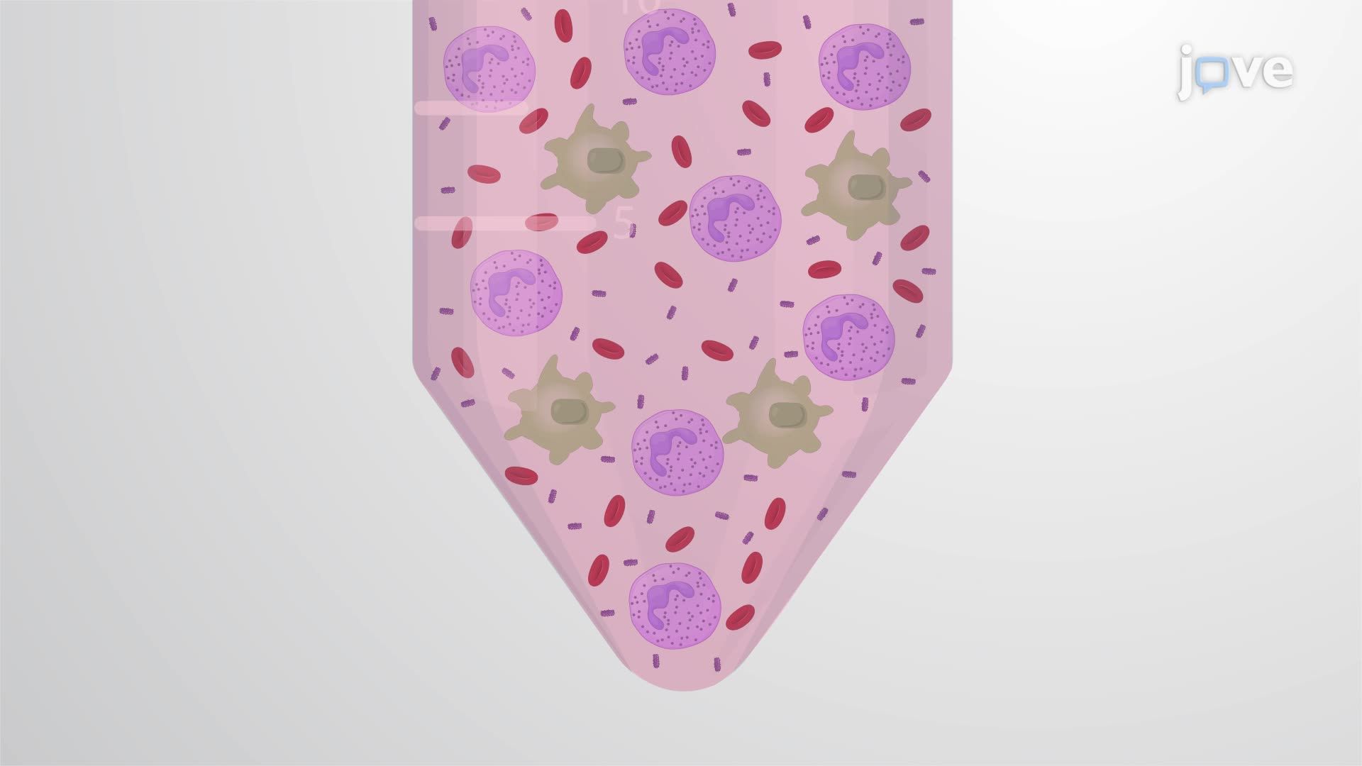 Bronchoalveolar Lavage Fluid Collection from a Mouse Model Infected with Non-typeable <i>Haemophilus influenzae</i>