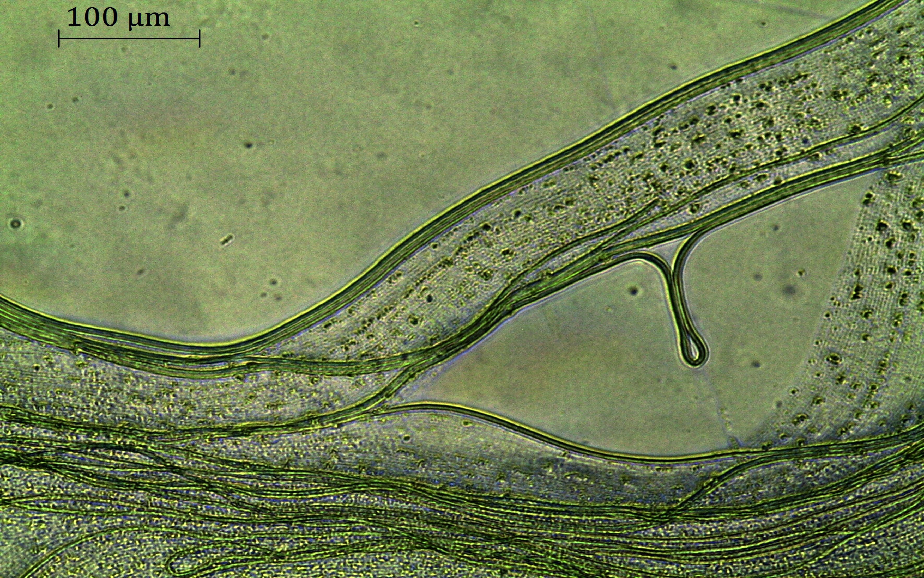 figure-results-1 Microscopy image of green algae filaments at 100 μm scale, focusing on cell structure and morphology.