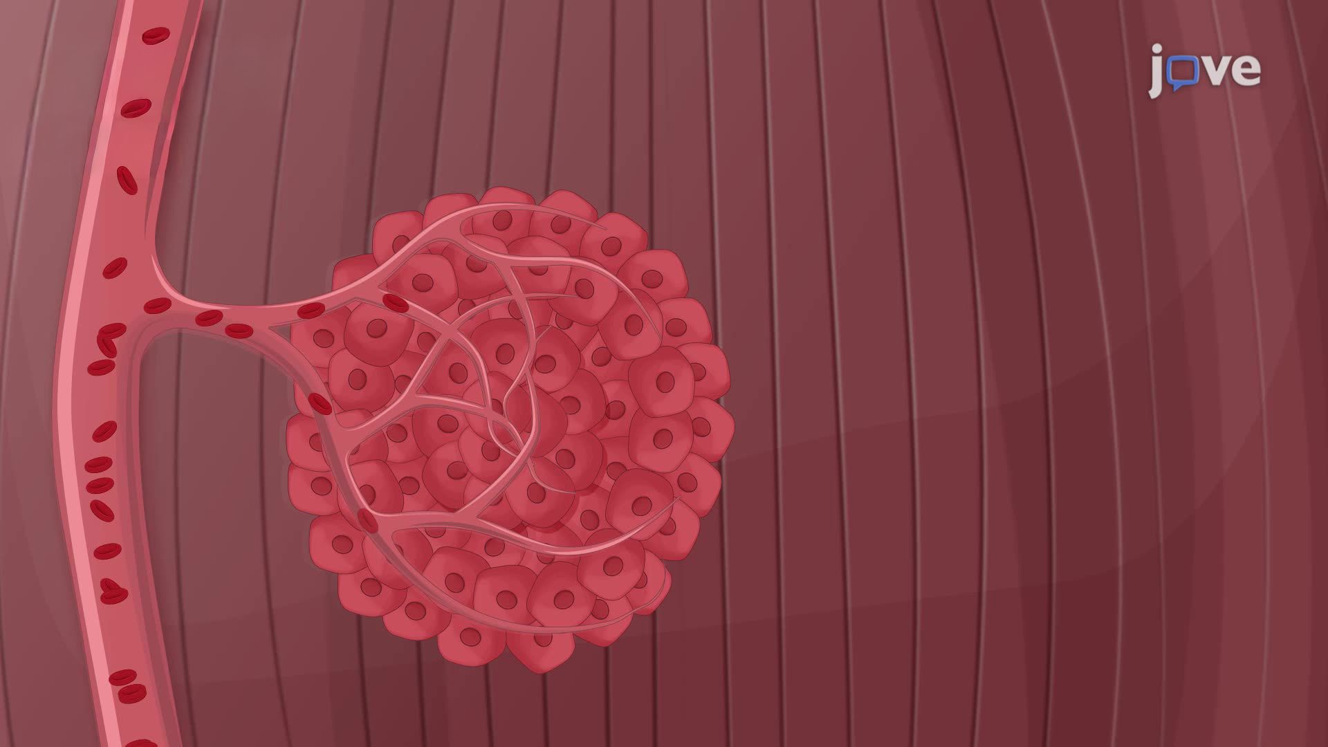 Bioluminescent Imaging of Breast Tumor Progression in a Female Mouse Model