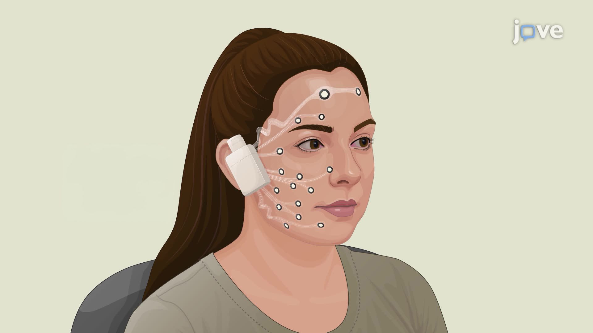 Wireless Surface Electromyography Recording of Facial Muscle Activity During Expressions