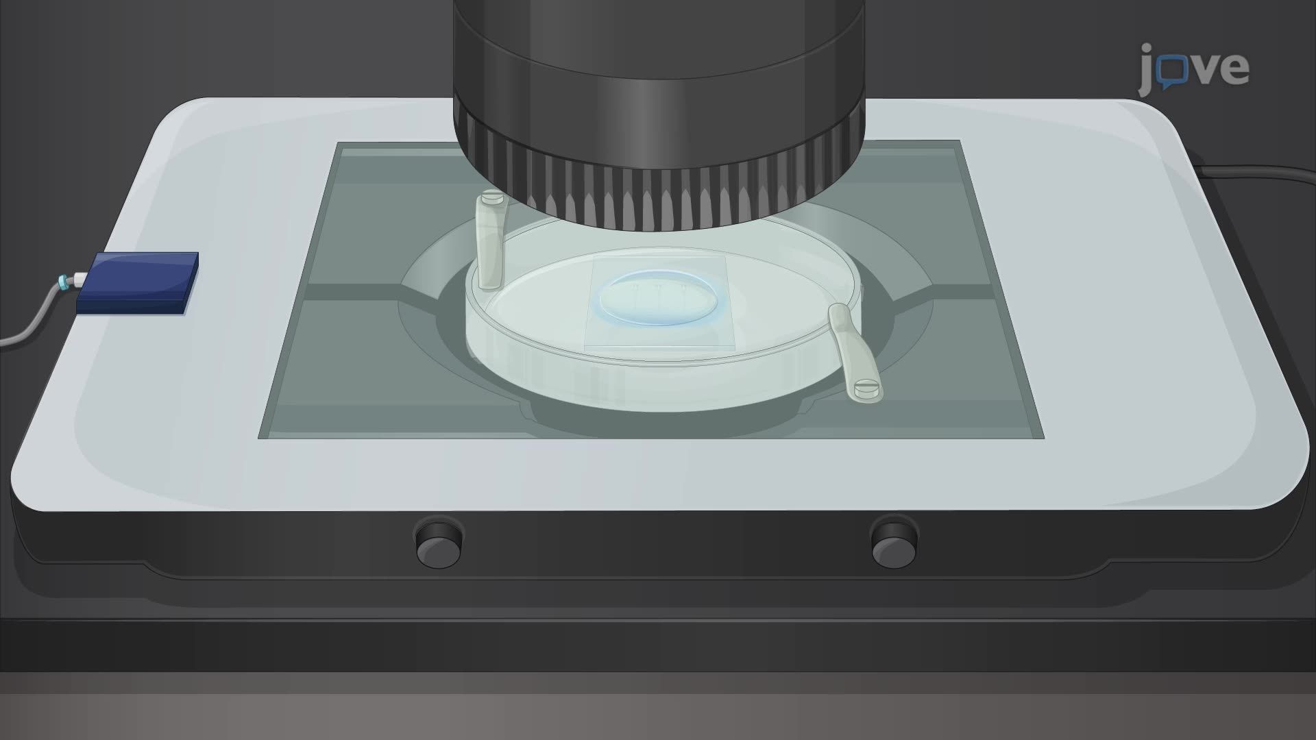 Live Imaging of Macrophage Cell Death During Mycobacterial Infection in Zebrafish Embryos