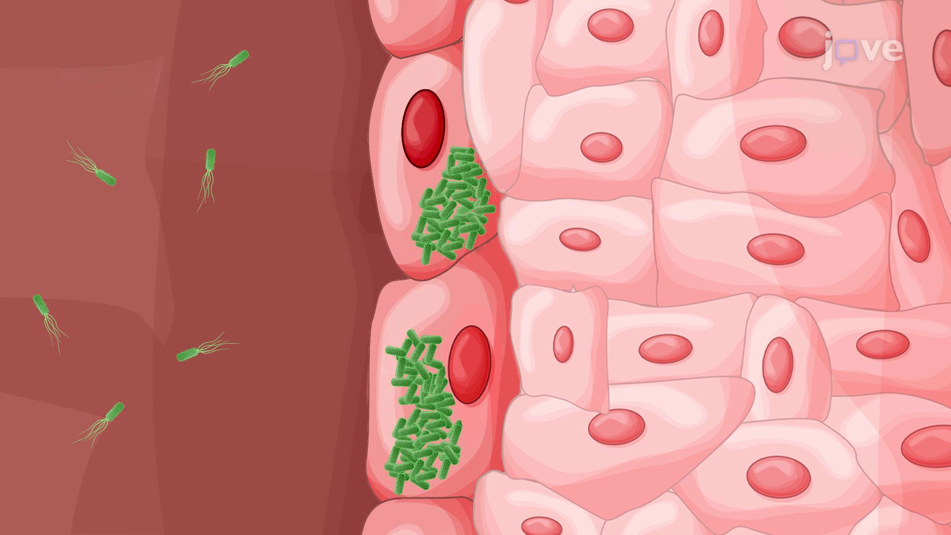 Visualization of Urinary Tract Infection in a Mouse Model Using Bioluminescence