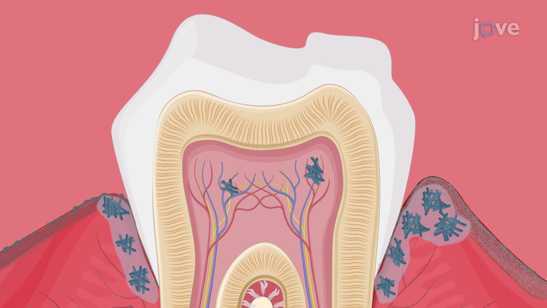 Oral Infection Alters the Gut Microbiota in a Rat Model