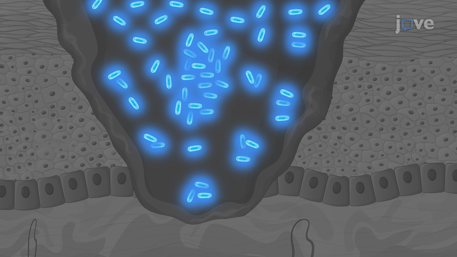 Bioluminescence Imaging of Acinetobacter baumannii-Infected Burn Wounds ...