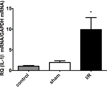 Figure 3B