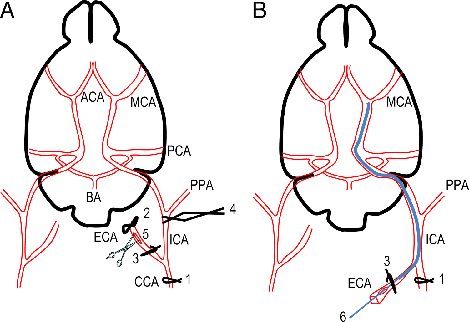 Mouse Model of Intraluminal MCAO: Cerebral Infarct Evaluation by Cresyl ...
