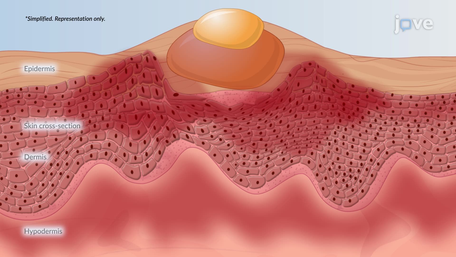 Thumbnail for Viral Infections